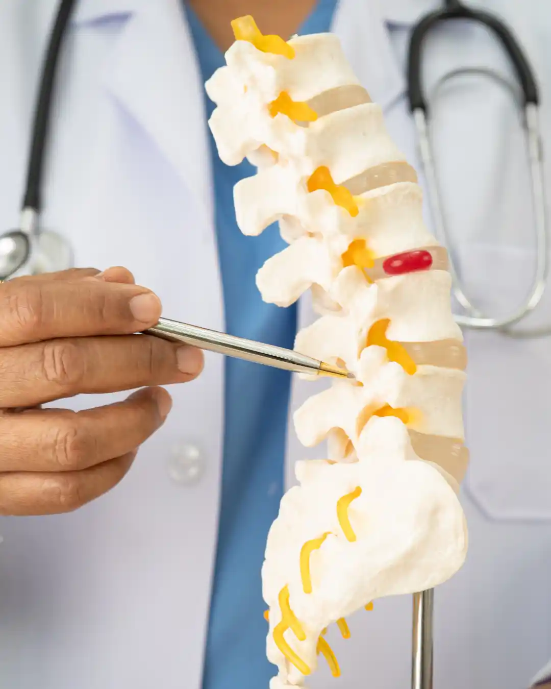 Fisioterapia Hérnia de Disco Zona Norte SP Dr Mauricio