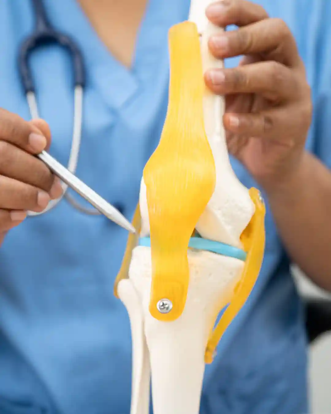 Infiltração Articular Ácido Hialurônico PRP PRF