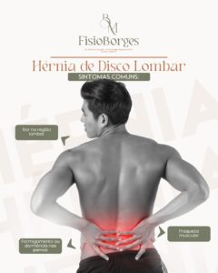 fisioterapia para hérnia de disco Zona Norte SP